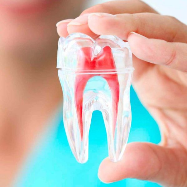 oraldoctor-endodontia-min